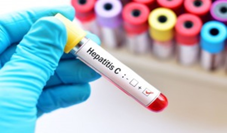 Detección gratuita de Hepatitis C en 18 provincias