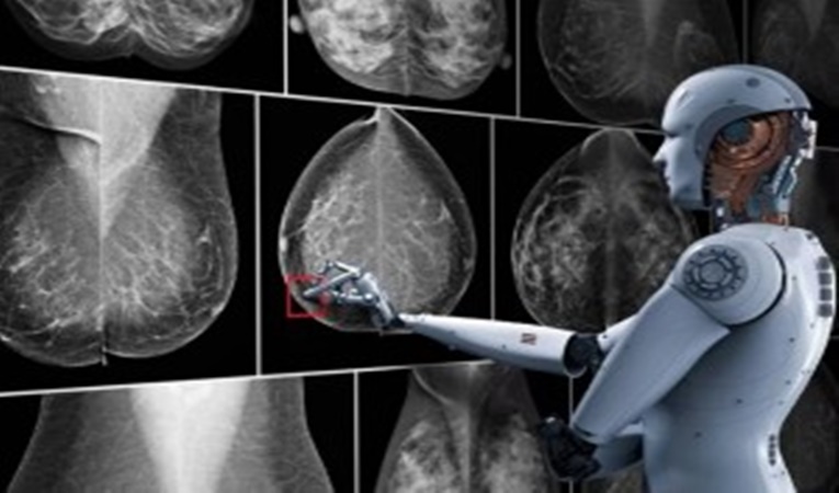 Como la IA puede detectar un Cáncer de Mama, según un nuevo estudio