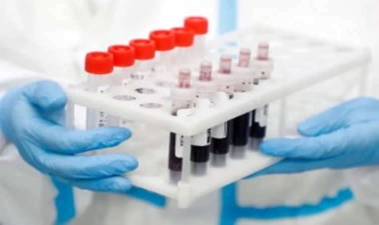 Cómo funciona el nuevo análisis de sangre que detecta 18 tipos de cáncer en etapas tempranas