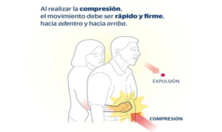 Atragantamiento: los cuidados ante las fiestas