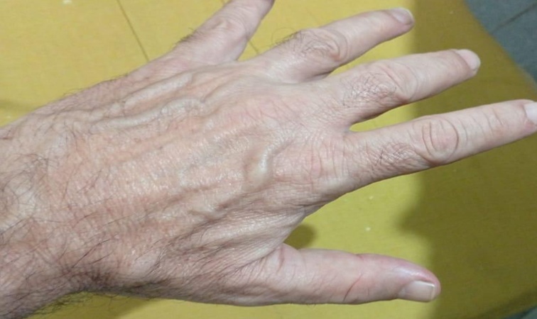 «Los argentinos no piden una mano, síno que se la saquen de encima»