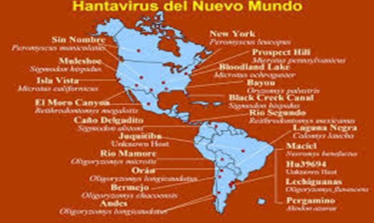 Hantavirus: síntesis clínica y epidemiológica